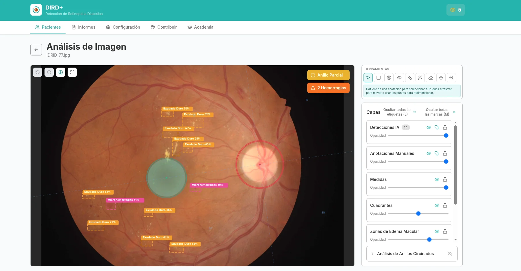 DIRD+ — Vista principal con detecciones de lesiones