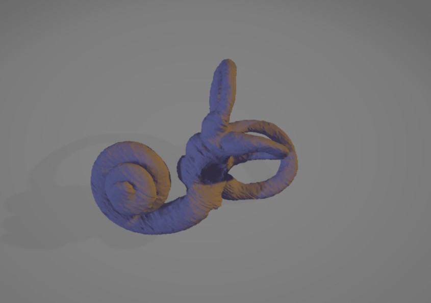 Oído Interno - Estructuras